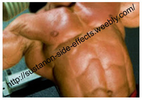 Steroid injections for acne side effects